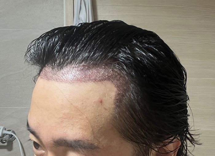 지문샴푸 후 쾌적함
