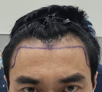 모종 디자인