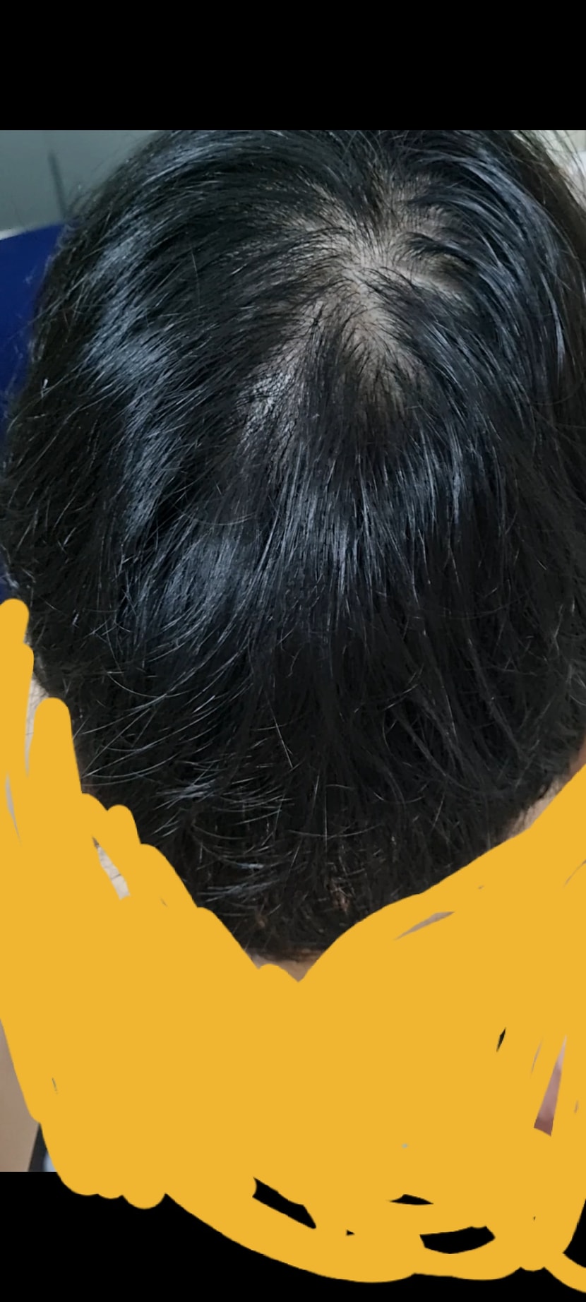 앞에서 찍은거