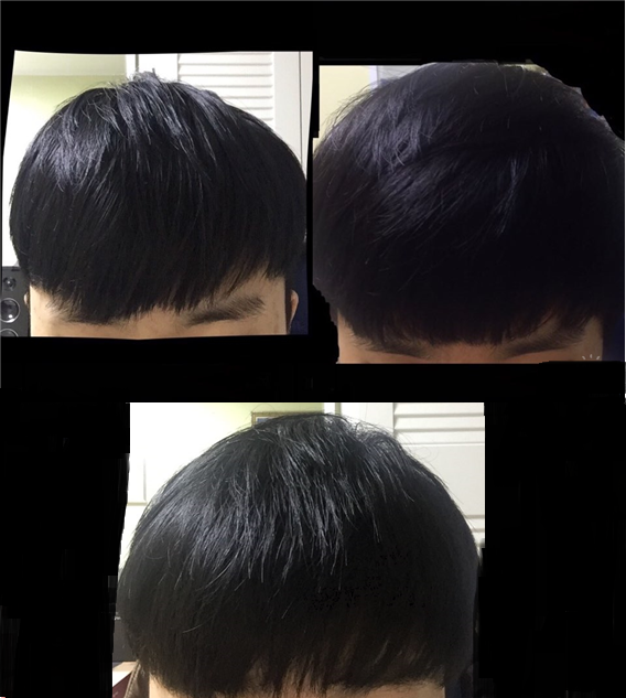 3번