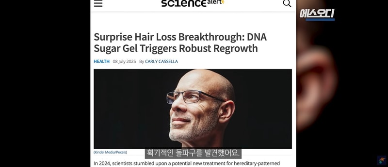 (최신뉴스) 드디어 탈모 근본 해결 방법 나오나요ㄷㄷ