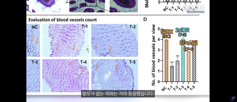 2dDR 바른 쥐는 탈모 없는 쥐랑 거의 비슷하다고 함