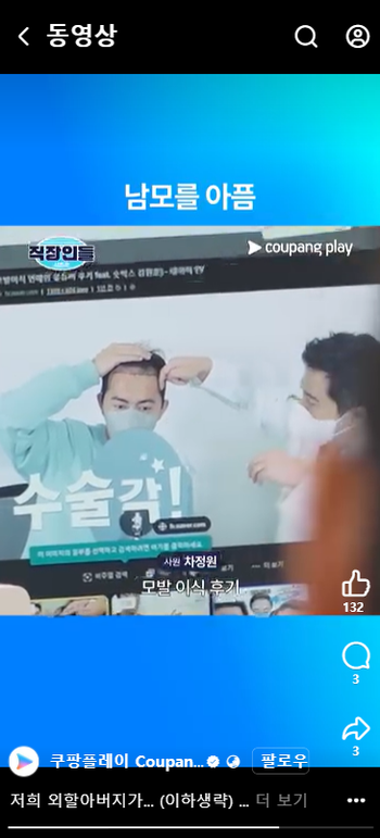 김원훈 모발이식 전 ㄷㄷ