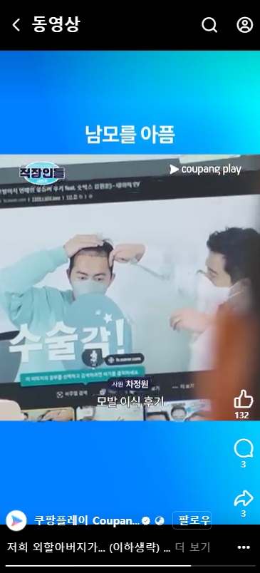 김원훈 모발이식 전 ㄷㄷ
