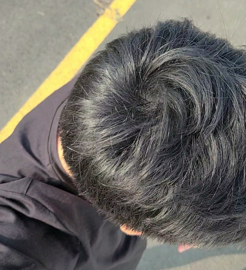 현재머리