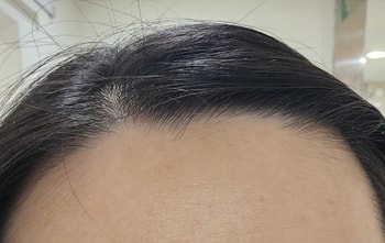 가르마 바꾸고 핀 찌름 1