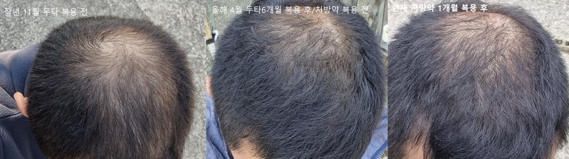 大家好 我正在服用处方药 我问你一个问题