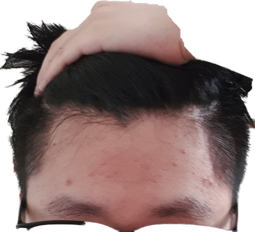 위쪽
