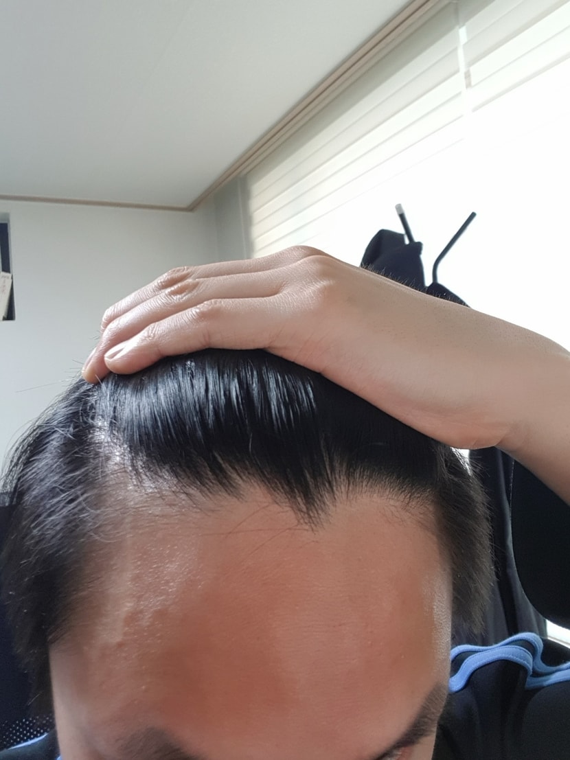 내 슬픈 머리통