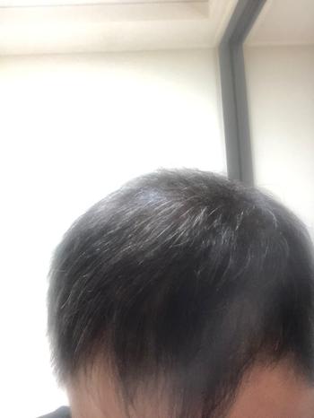 윗머리