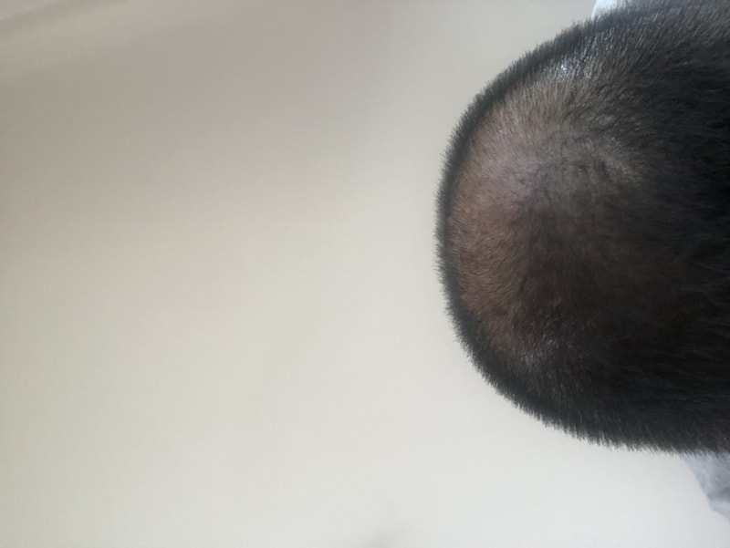 这里是极限吗？