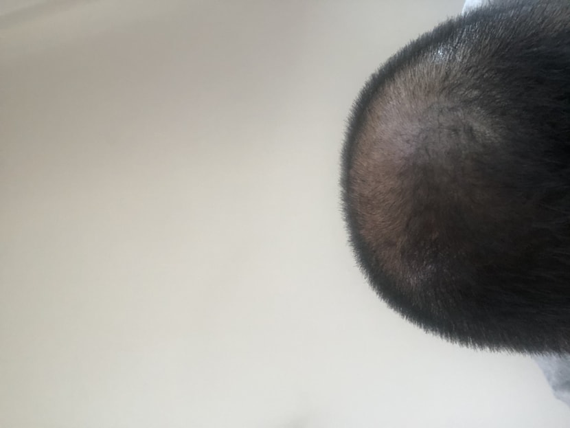 현재