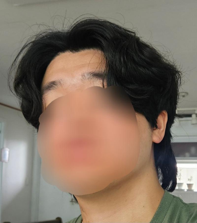 여러분은 조명 바로 아래에서 두피가 얼마나 보이시나요?