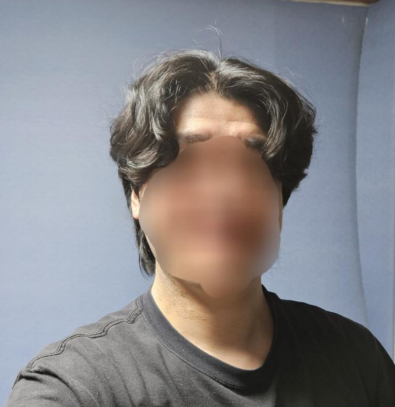 앞머리 탈모 심해보이나요...?ㅠㅠㅠ