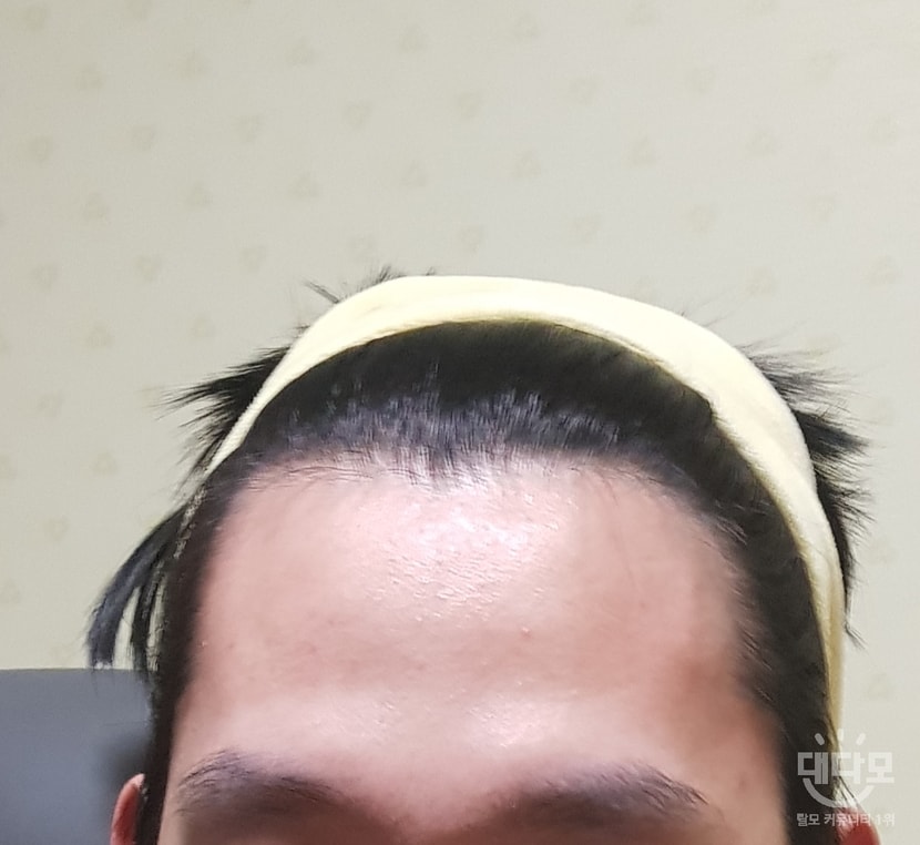 1년전