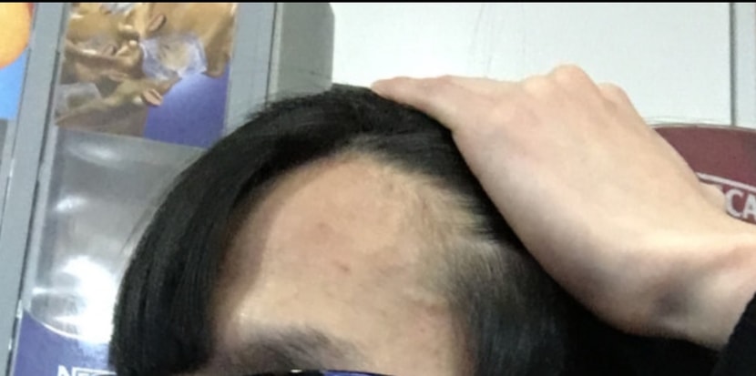 이건 5년전 헤어라인입니다