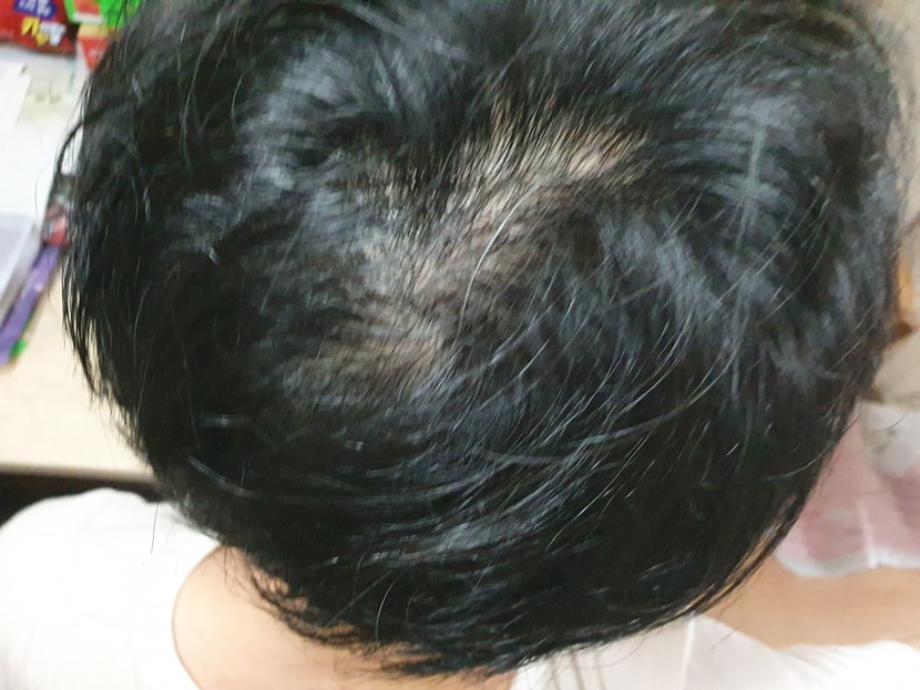 이사진이 4월 28일(현재)사진입니다