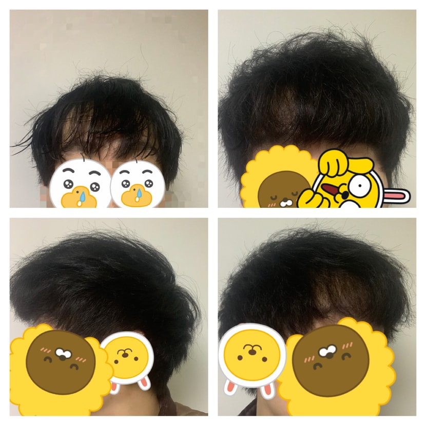 머리감고 직후 앞머리 말린후 앞머리 앞머리 오른쪽 앞머리 왼쪽(시계방향순 입니다. )