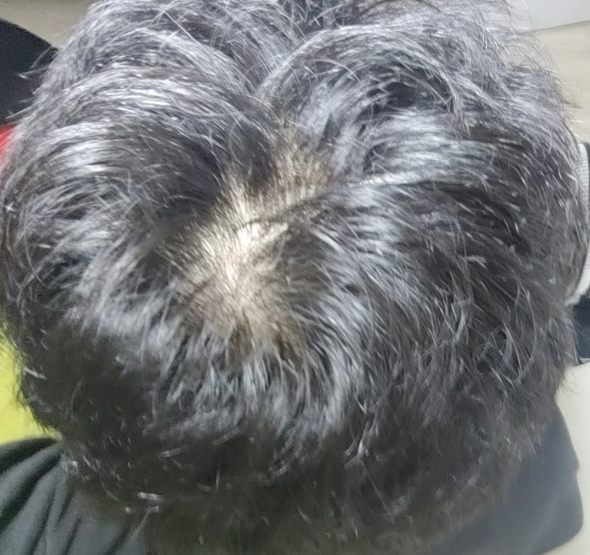 오늘 머리감고