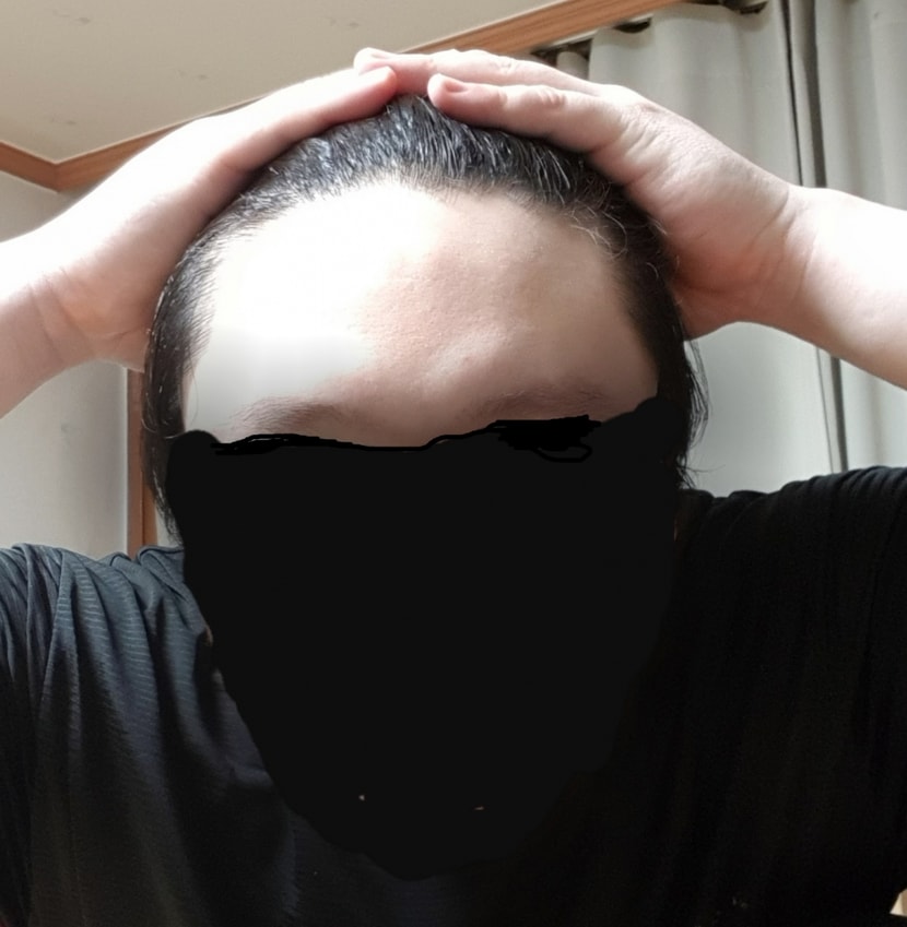 정면