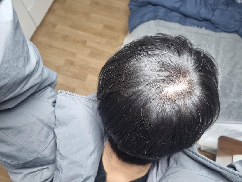 빛 바로아래에서 촬영