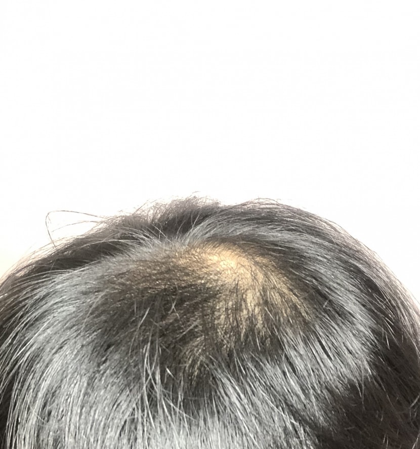 현재