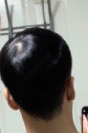약복용전 전역한지 얼마안되서 머리가 짧은것도 있어요