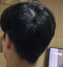 약복용 7개월차