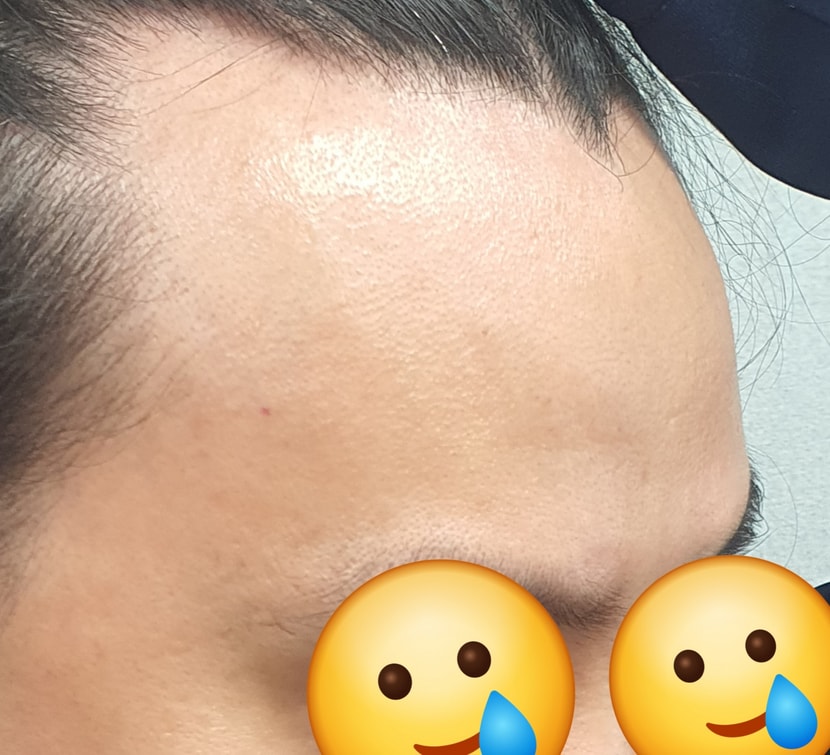 고통받는 이마