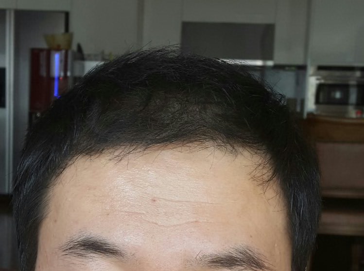 현재