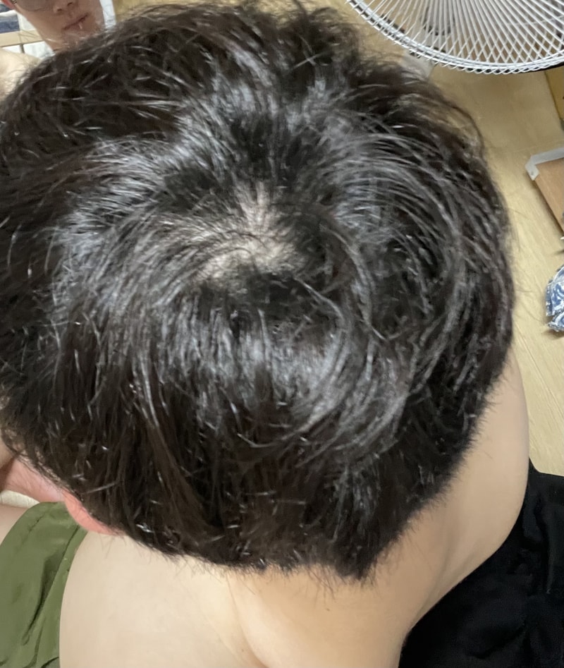 頭頂部がかなり空いて見えますか？