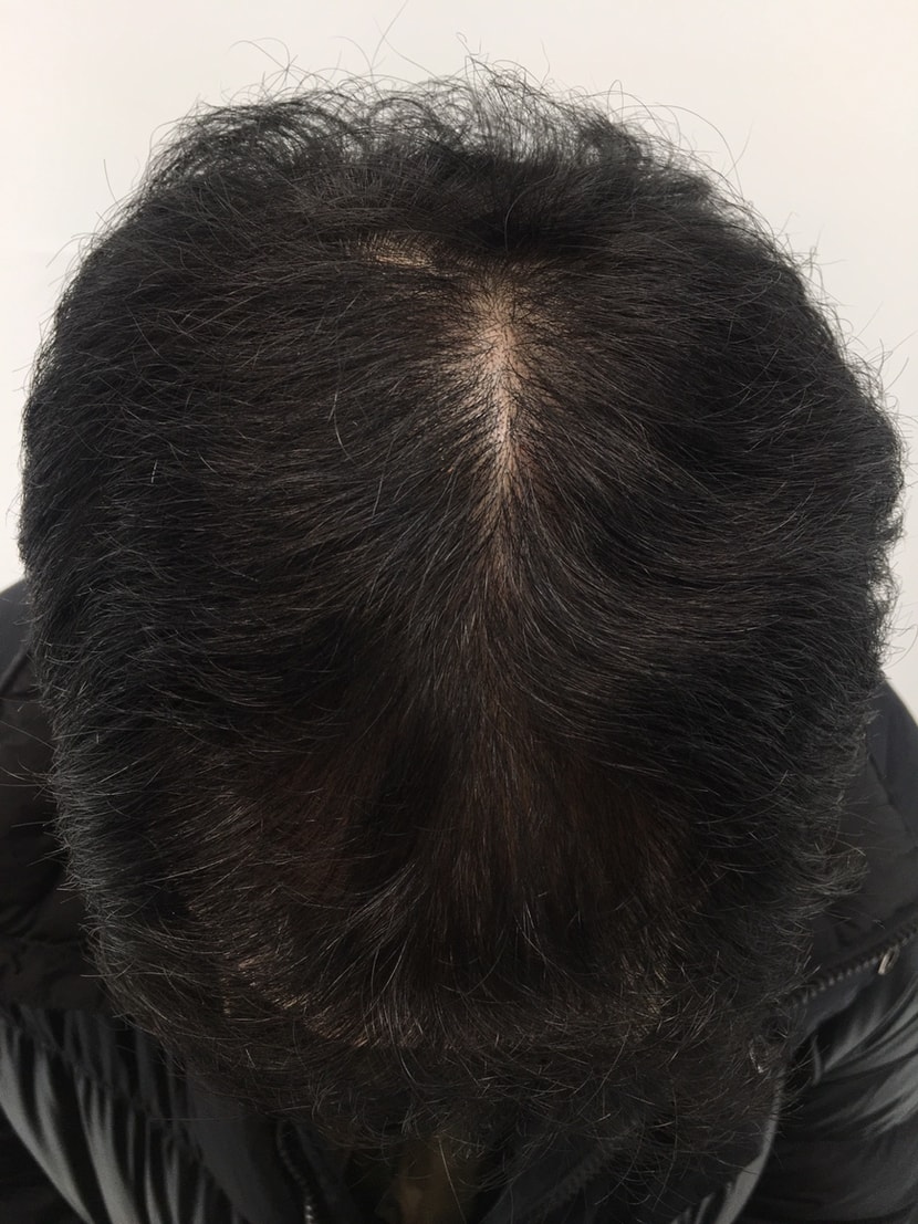 일주일전