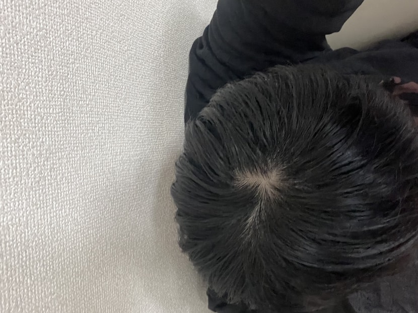 21일차 머리 자른 후