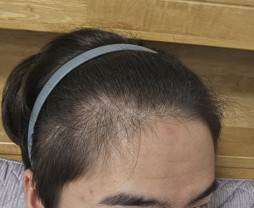 현재