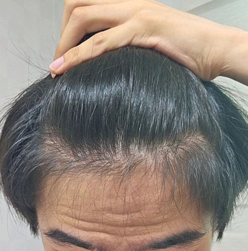 9개월전