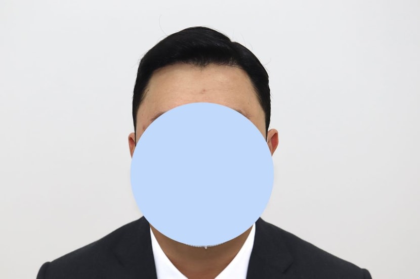 수술 후(7개월)