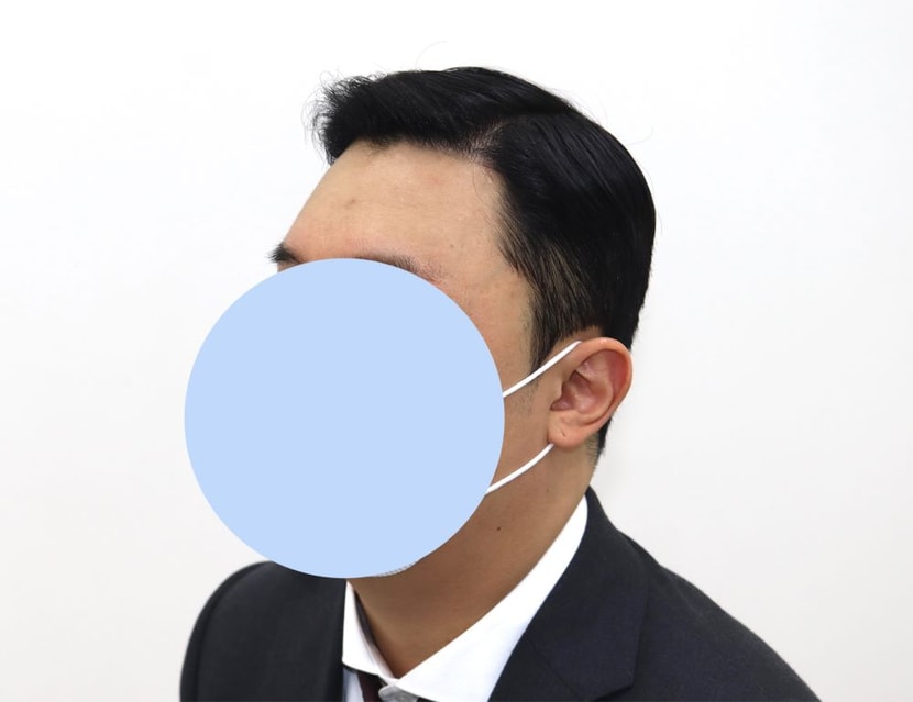 수술 후(7개월)