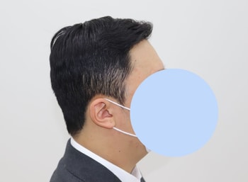 수술 후(7개월)