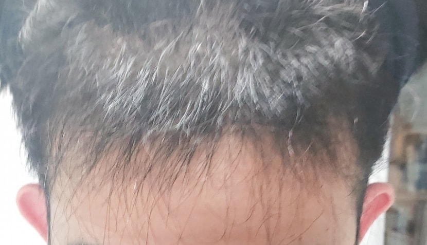 5개월차 사진