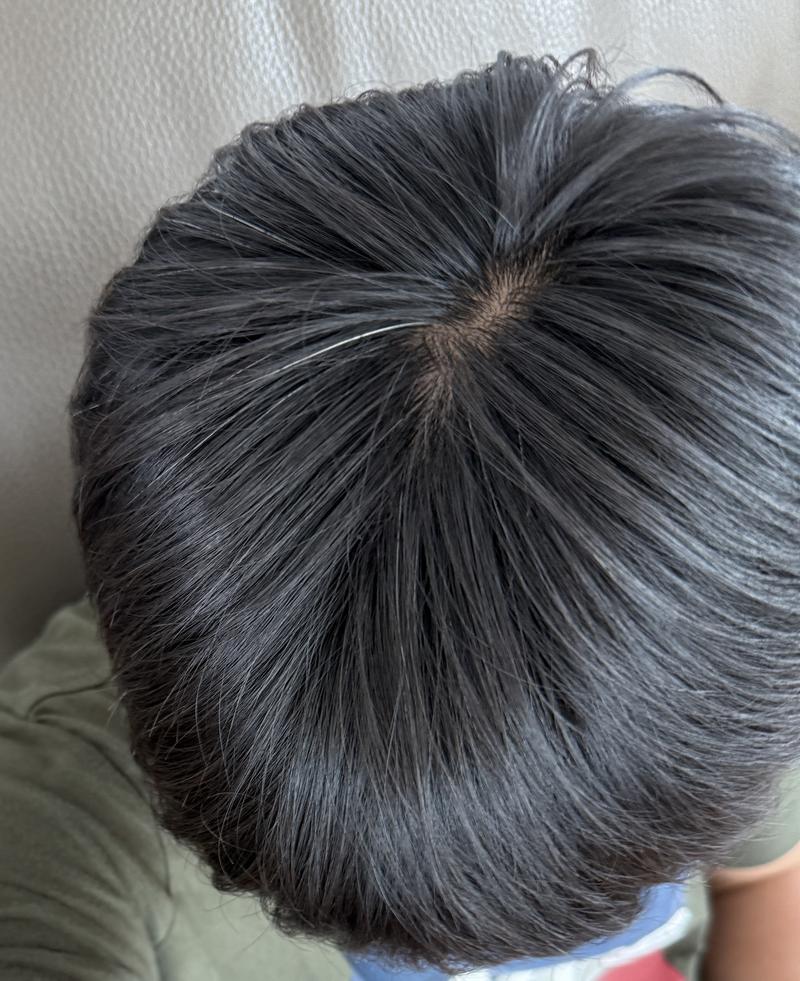 정수리 어때보이시나요?..