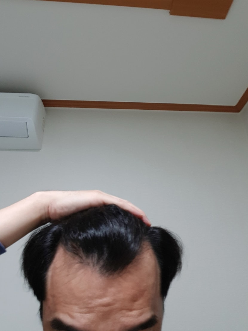 엠자 정면