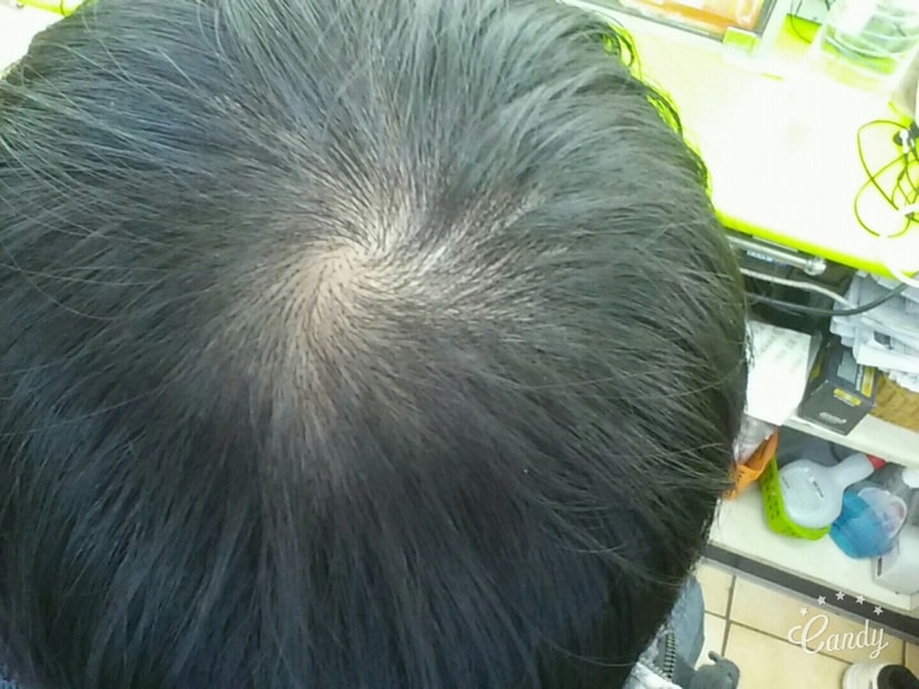 16년