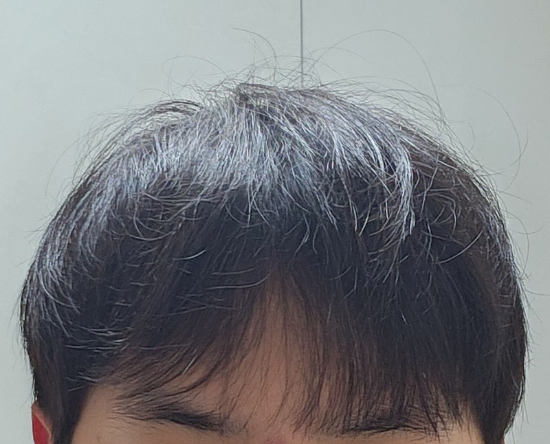 大家的发胶要用到什么时候？