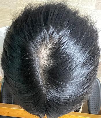 5년전