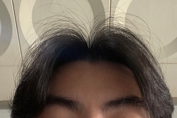 복용후