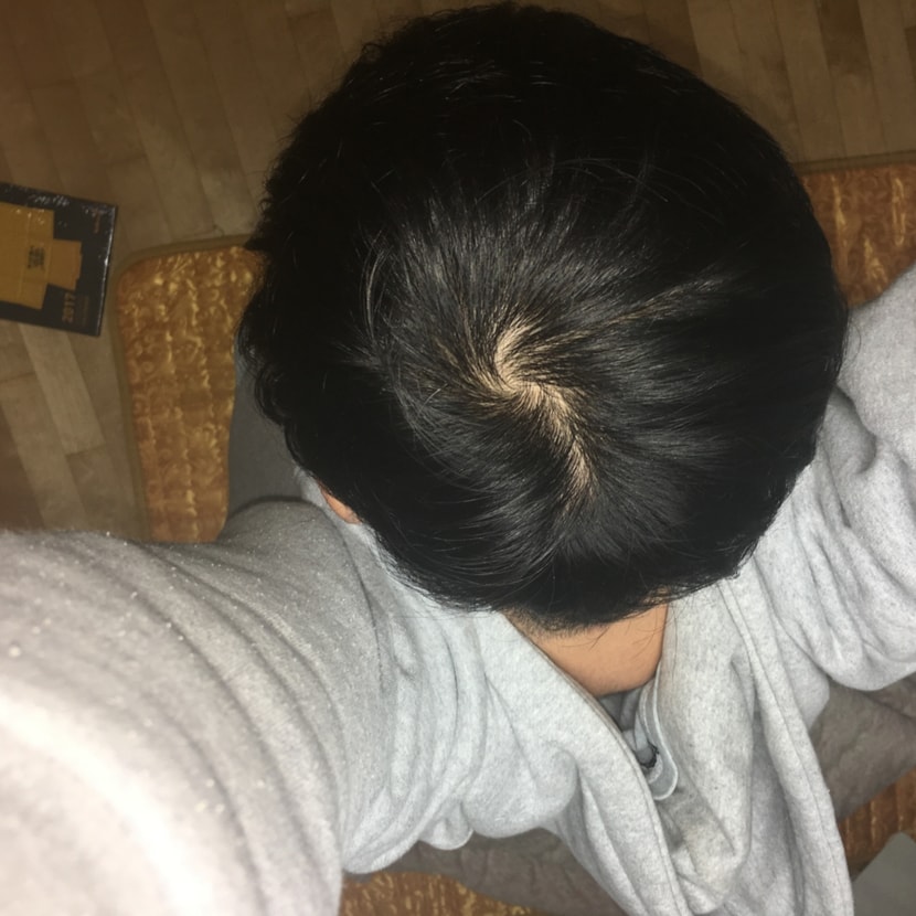 12.04(5)