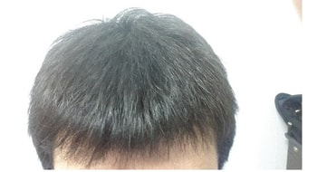 정면