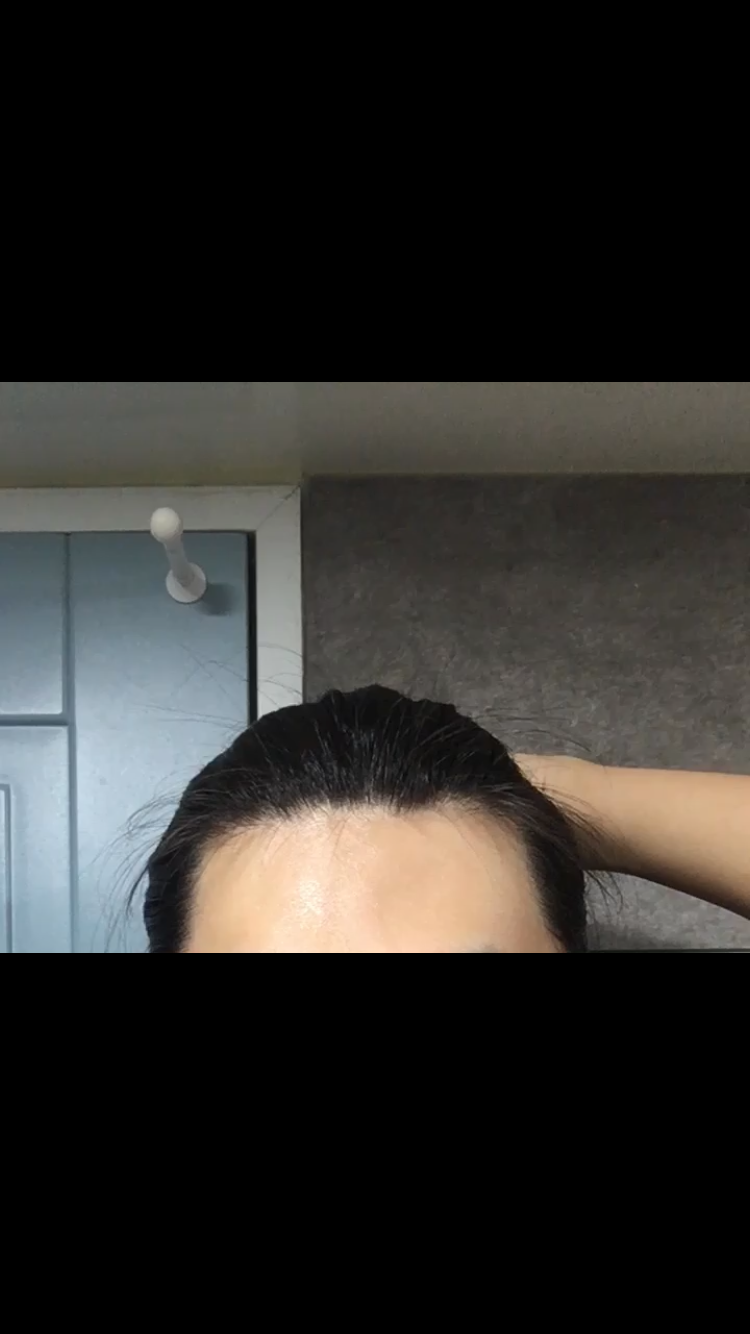 정면 (파여보이는 곳이 왼쪽)