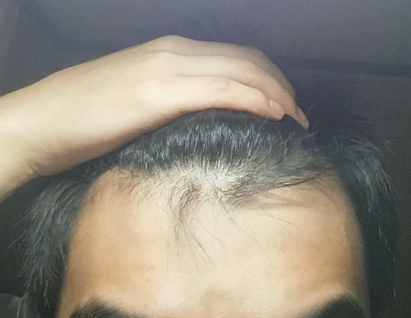 앞머리..
