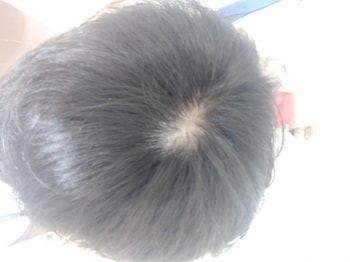 1번 사진을 찍고 몇 초 안 지나 또 찍은 사진